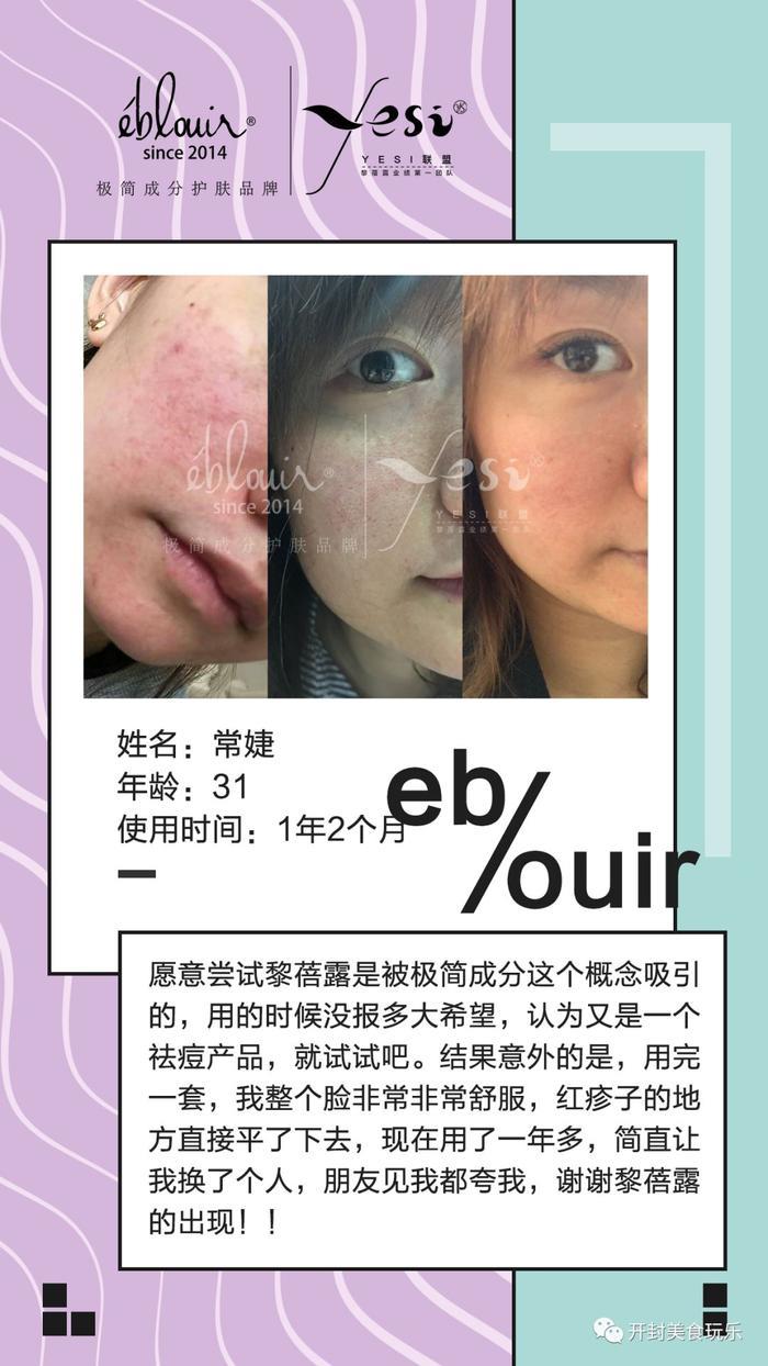 开奖 | 好羡慕你马上就有好皮肤了！黎蓓露护肤套系花落谁家？